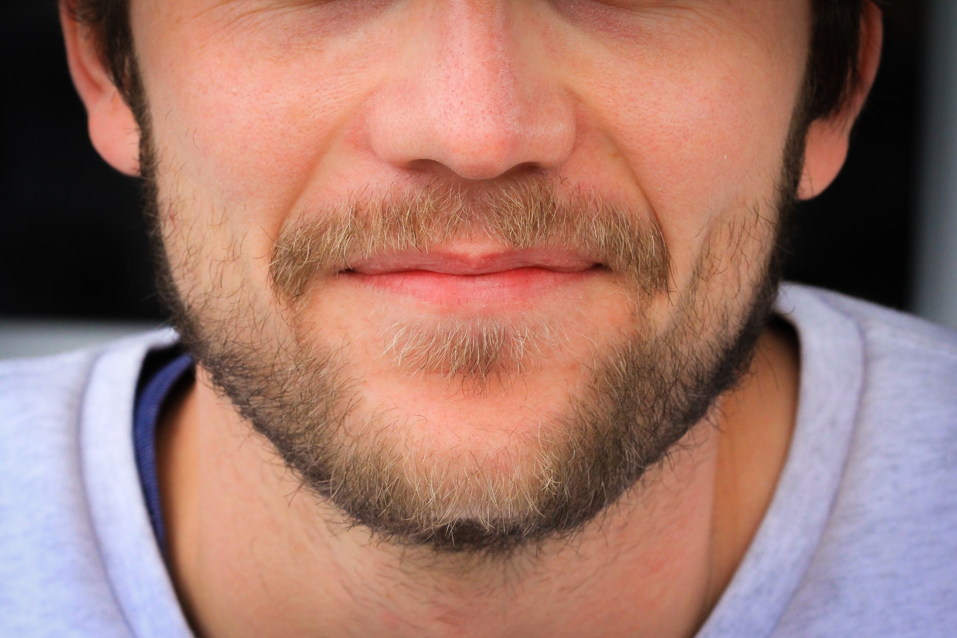 Can Ingrown Facial Hair Really Be Prevented?
